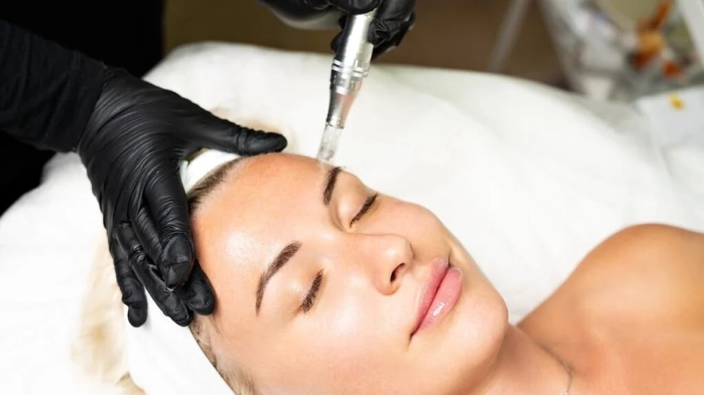 Understanding Microneedling and Other Aesthetic Treatments