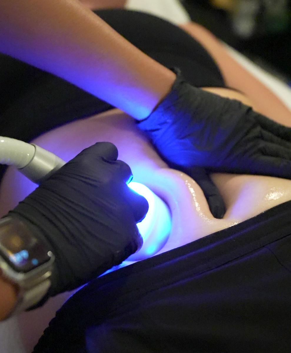 Body Contouring